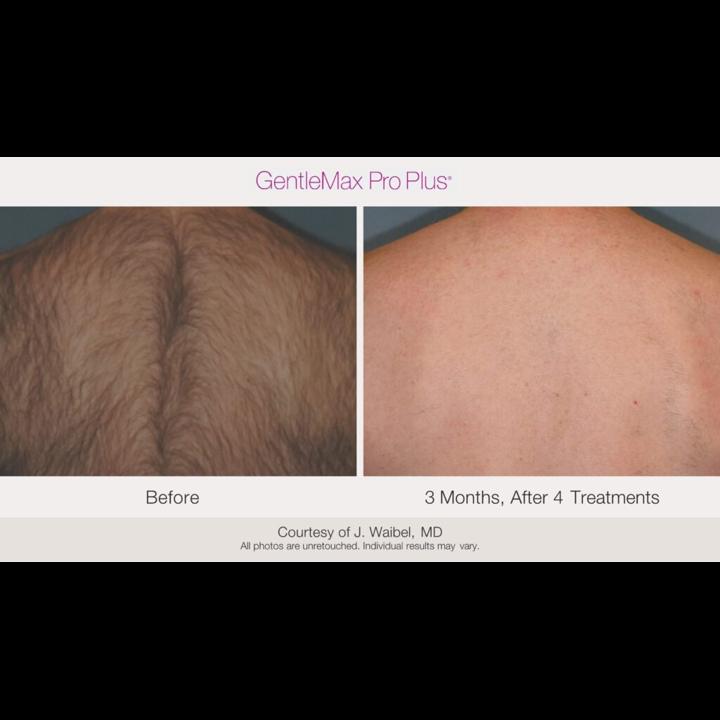 GMPP-Before-and-Afters_10-1024x576